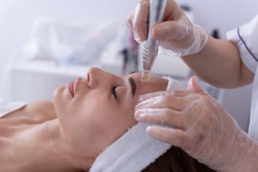 microneedling microneedling