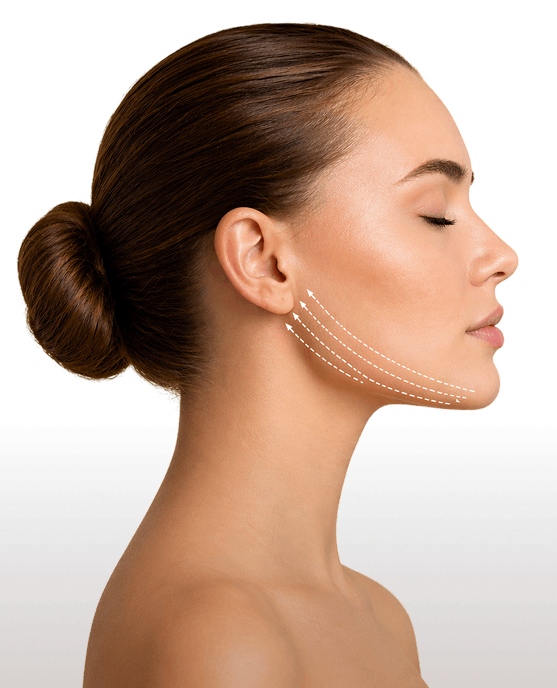 Injection de fillers